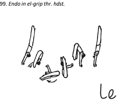 Endo in el-grip thr. hdst.